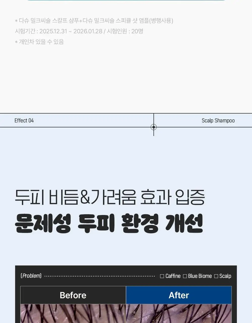 [포켓몬 에디션]다슈 데일리 밀크씨슬 블루바이옴 스칼프 샴푸 500ml(+피카츄 샴푸브러쉬) 상세페이지 35